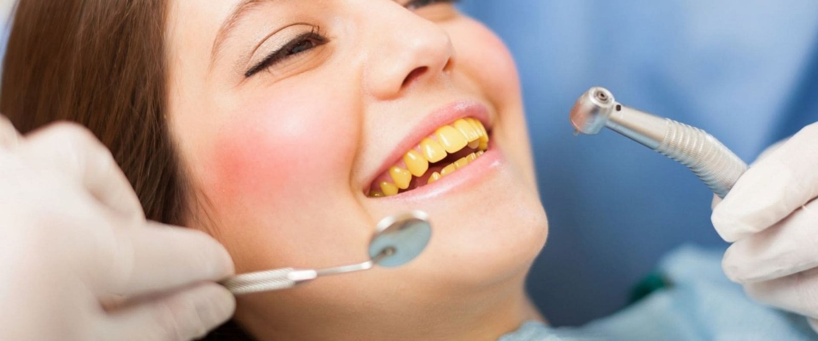 Sonrisa de ejemplo antes de un tratamiento, imagen ilustrativa